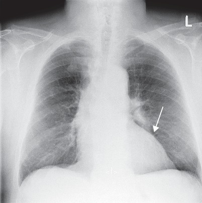 Fig. 19.12