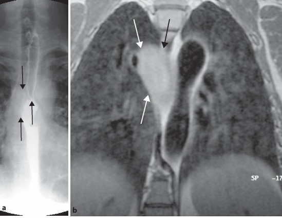 Fig. 19.116a,b