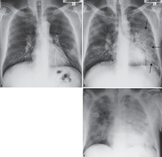 Fig. 19.48a–c