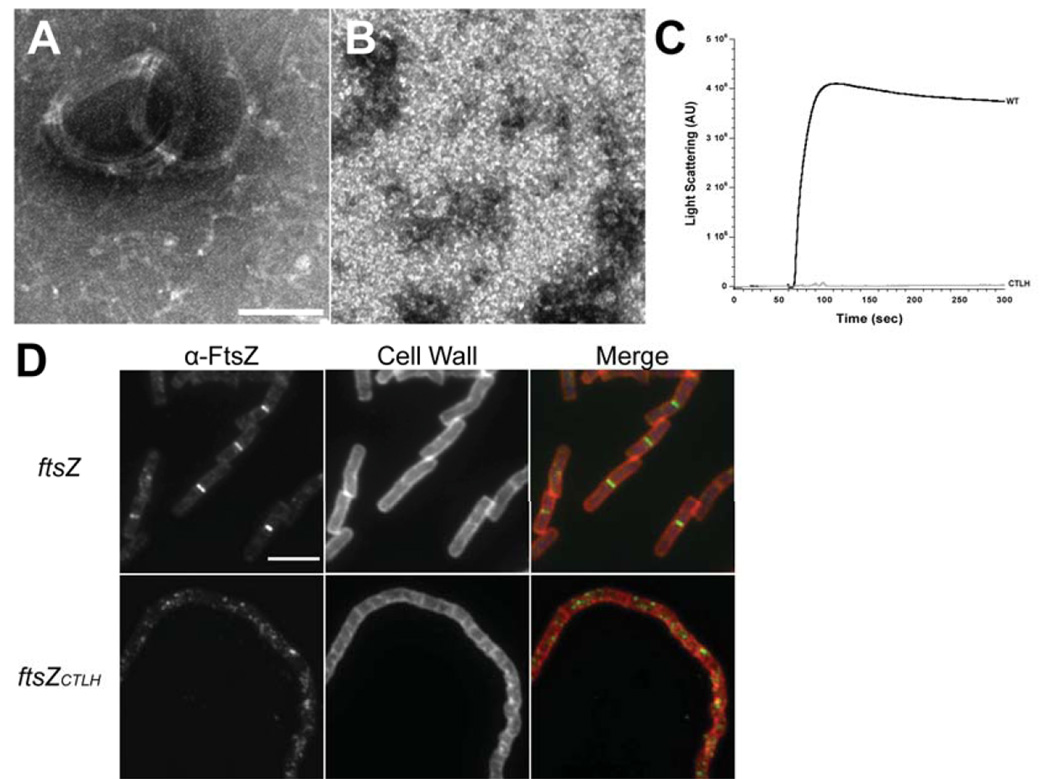 terminal linker is required for proper FtsZ assembly in Biology Diagrams