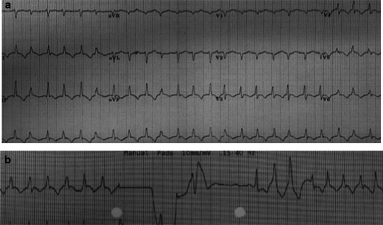 Fig. 2