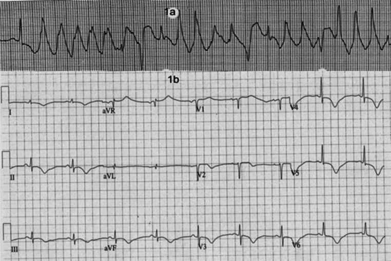 Fig. 1