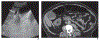 Fig. 1—