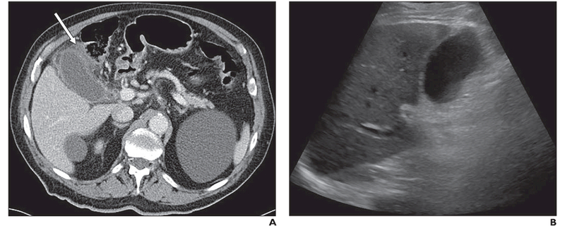 Fig. 2—