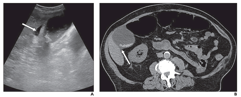 Fig. 1—