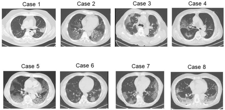 Fig. 1