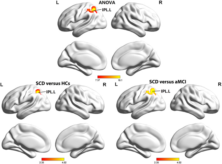 FIGURE 3