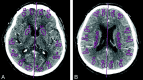Fig 1.
