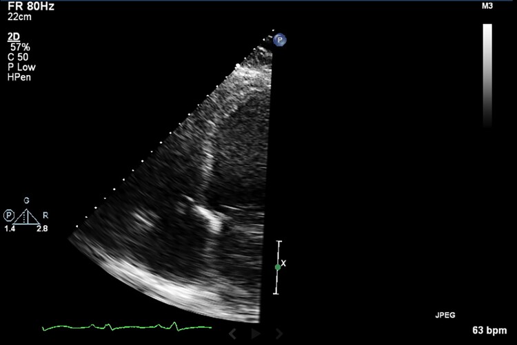 Figure 1