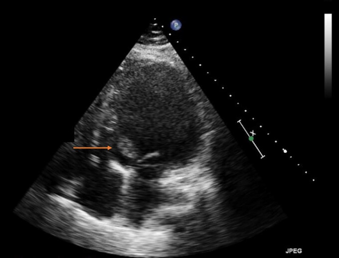 Figure 2