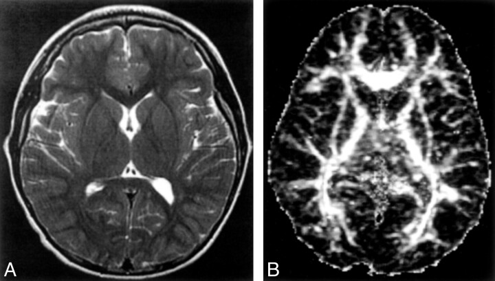 Fig 2.