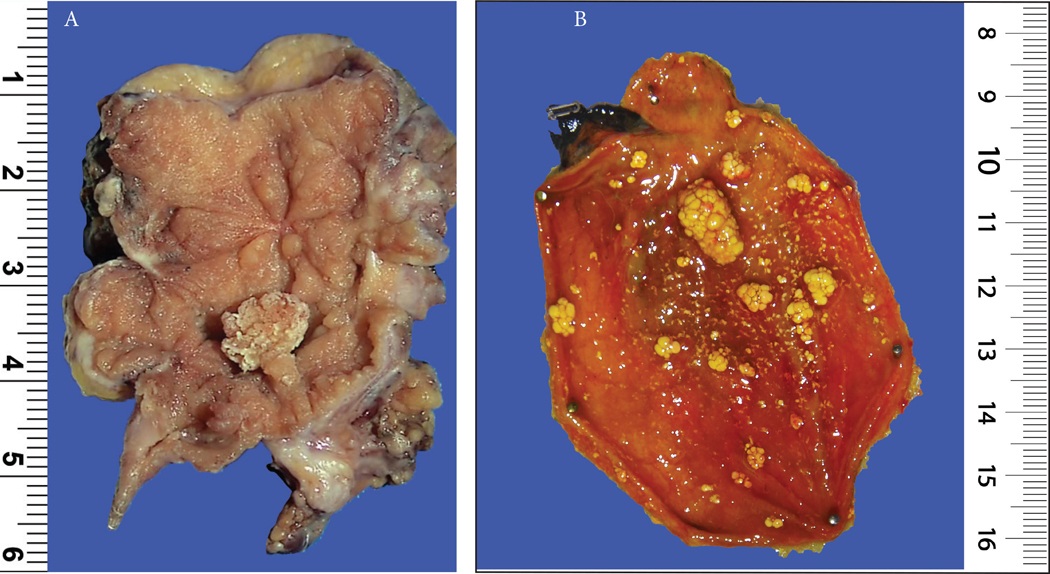 Figure 2: