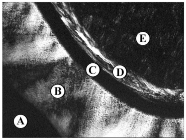 Fig. (10C1)