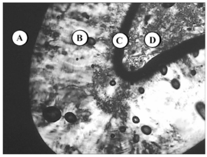 Fig. (10A1)