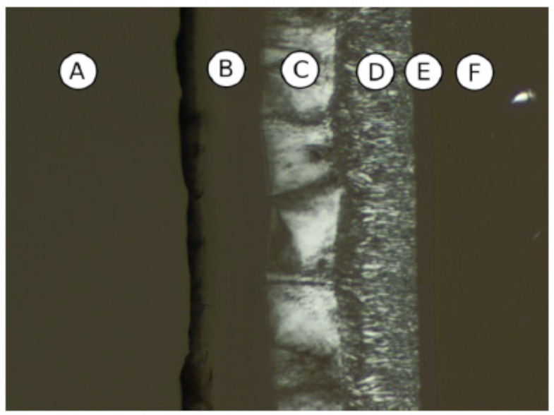 Fig. (11A1)