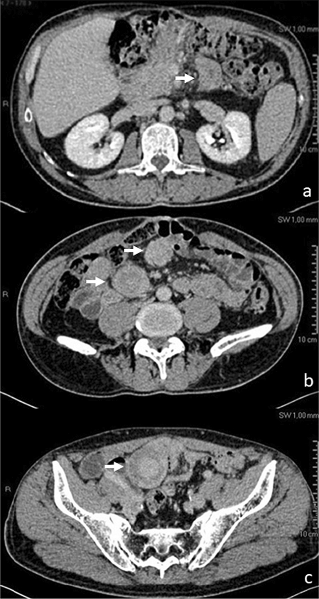 Fig. 2