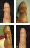 Fig. 4