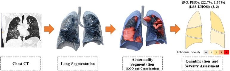 The system takes as input a non-contrasted chest CT and segments the lesions, lungs, and lobes into three dimensions. It outputs two combined measures of the severity of lung and lobe involvement, quantifying both the extent of COVID-19 abnormalities and presence of high opacities. The first measure (Percentage of Opacity, Percentage of High Opacity) or (PO, PHO) is global, while the second measure consists of (Lung Severity Score, Lung High Opacity Score) or (LSS, LHOS) is lobe-wise (see section COVID-19 Severity Metrics). GGO = ground-glass opacities