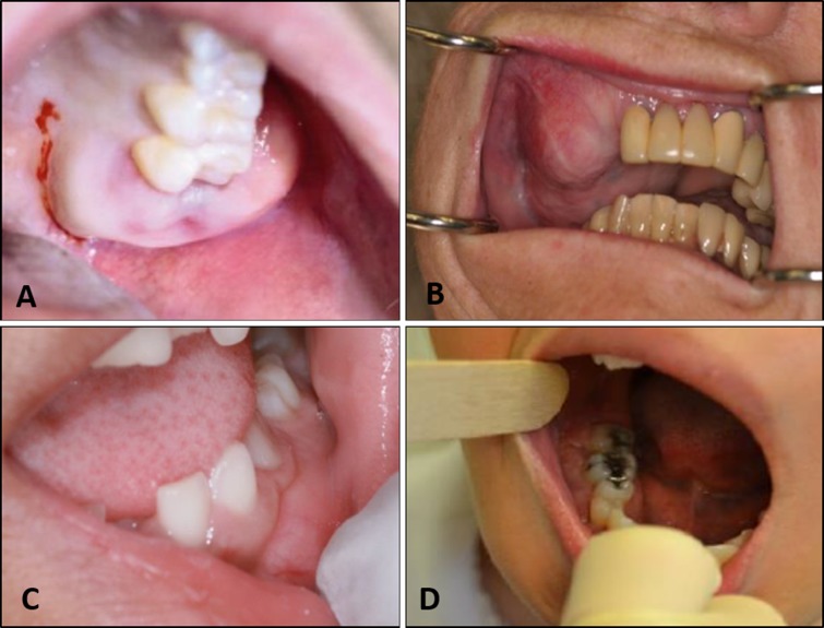 Fig. 1