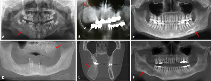 Fig. 2
