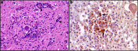 Fig. 4