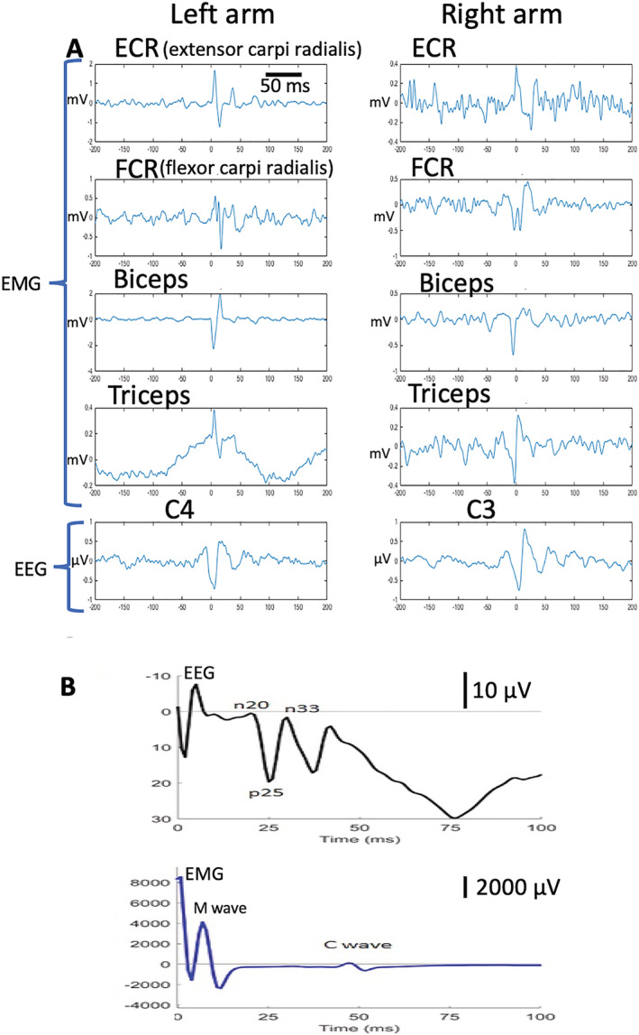 FIG. 1