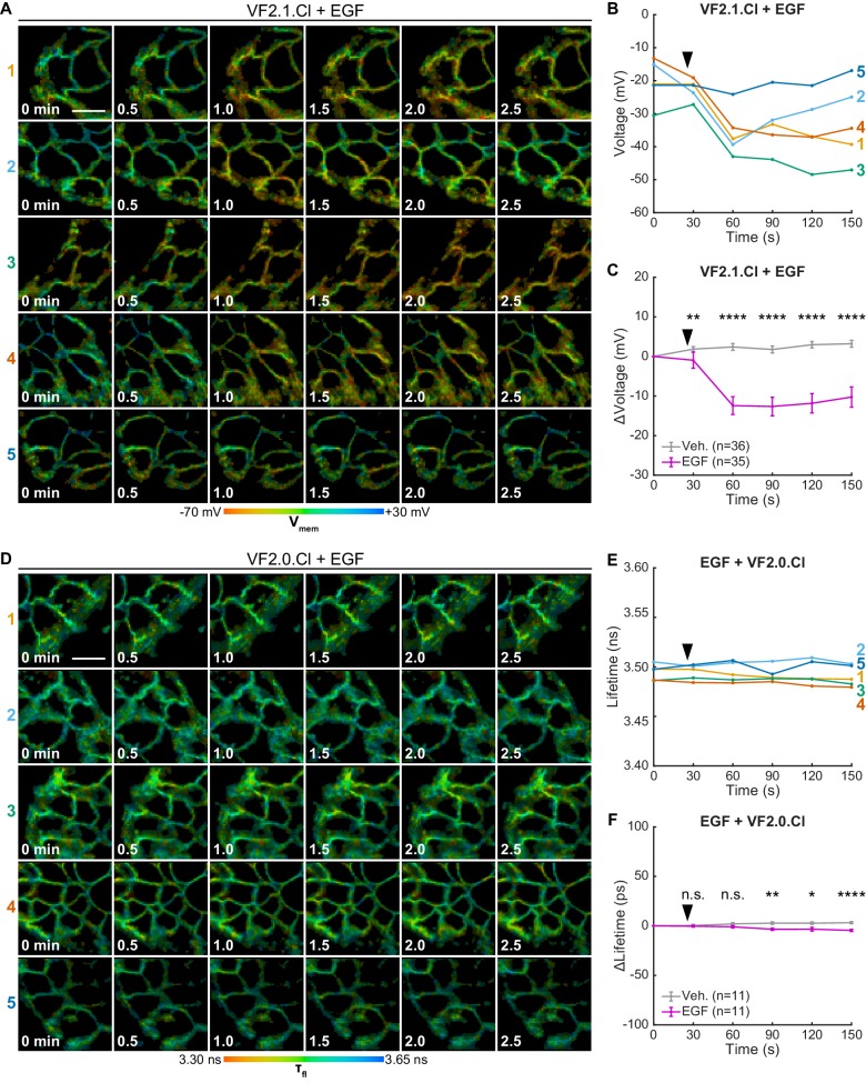 Figure 4—figure supplement 1.