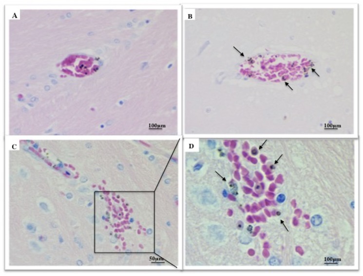 Fig 13