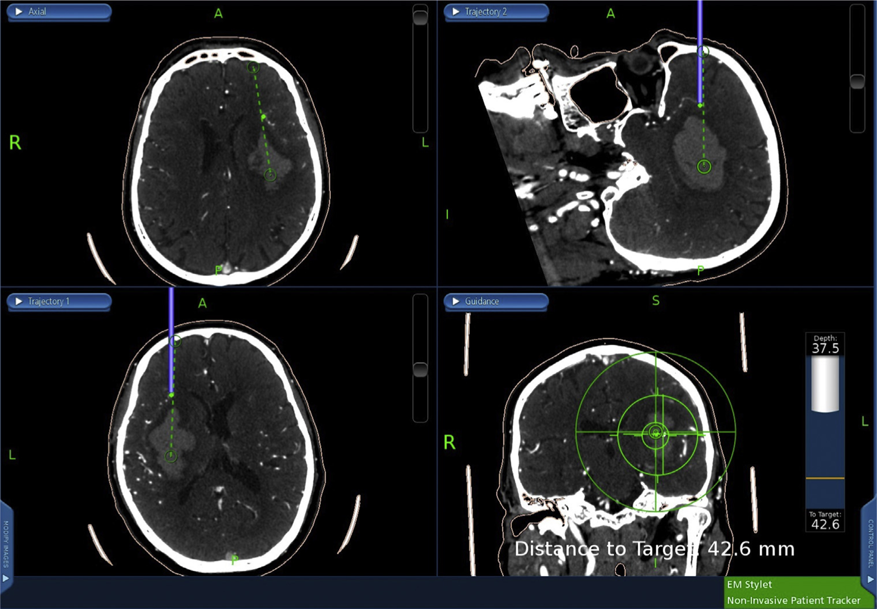 Figure 4.