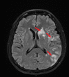 FIGURE 3