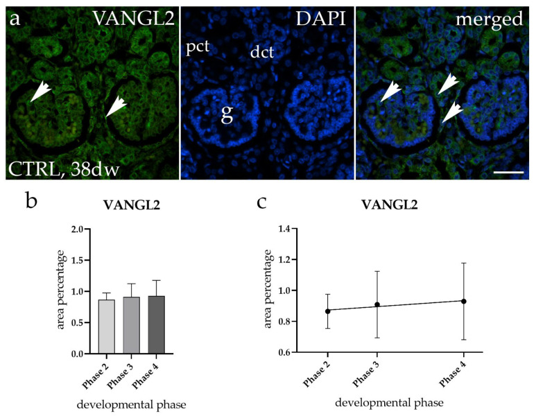 Expression Profiles of ITGA8 and VANGL2 Are Altered in Congenital ...