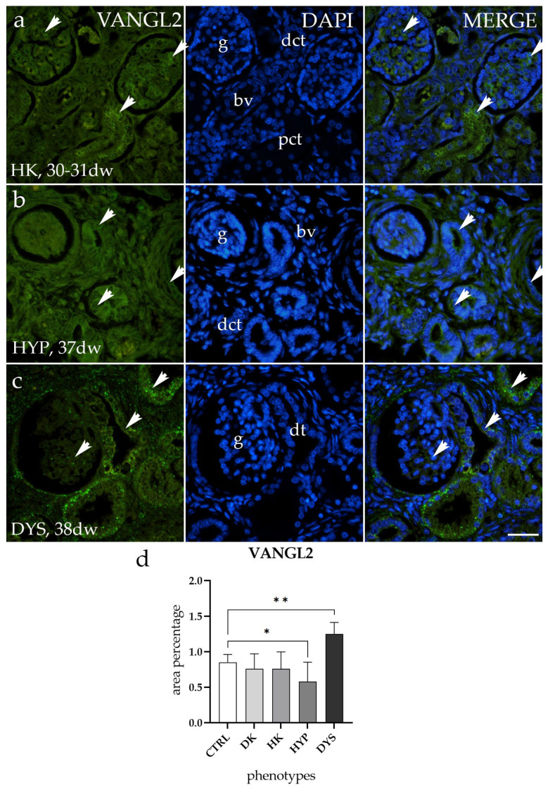 Expression Profiles of ITGA8 and VANGL2 Are Altered in Congenital ...