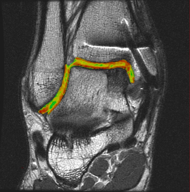 Figure 12.