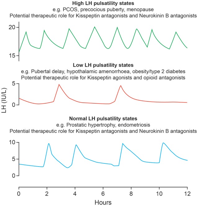 Figure 4