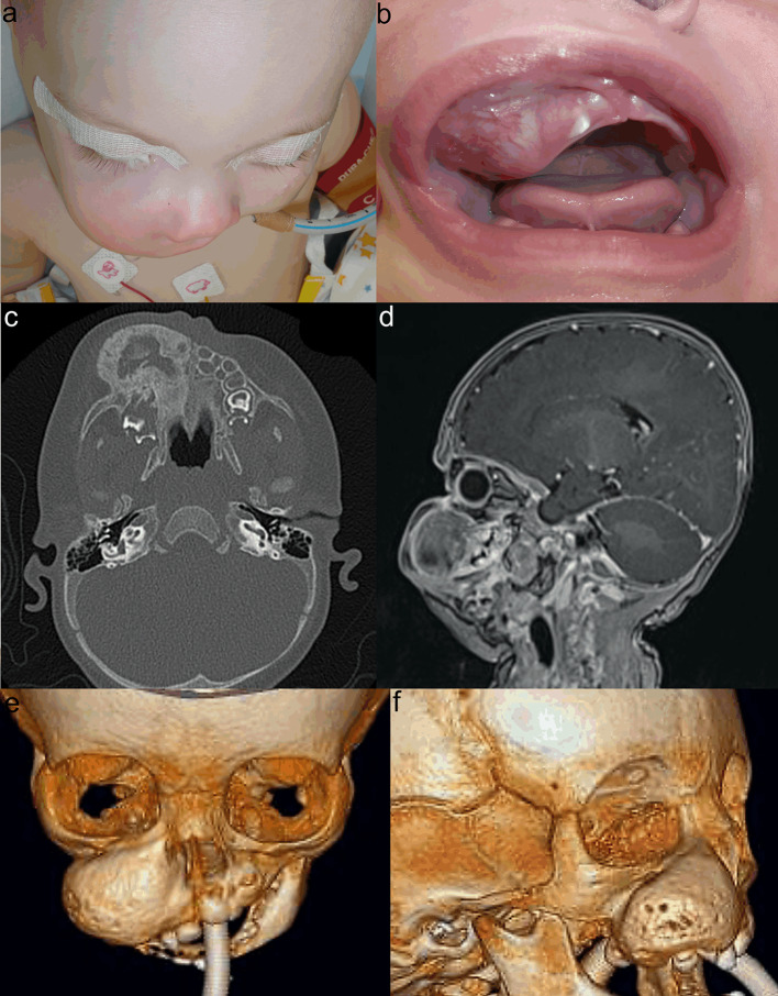 Fig. 1