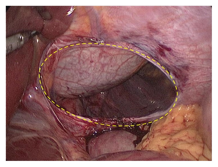 Figure 5