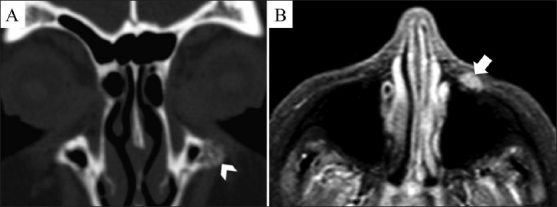 Figures 3 (A, B)