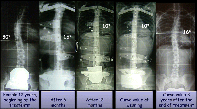 Fig. 4
