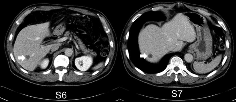 Figure 2