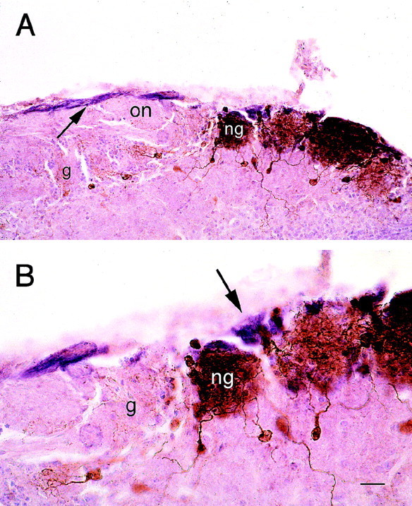 Fig. 10.