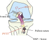 Fig. 2
