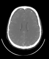 Figure 2b: