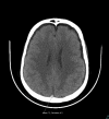 Figure 2a: