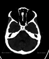 Figure 1a: