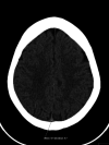 Figure 1b: