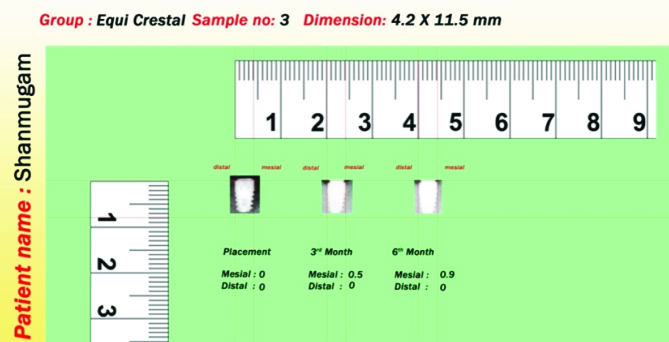 [Table/Fig-7]: