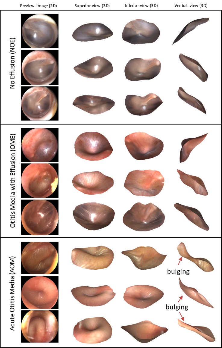 Fig. 11