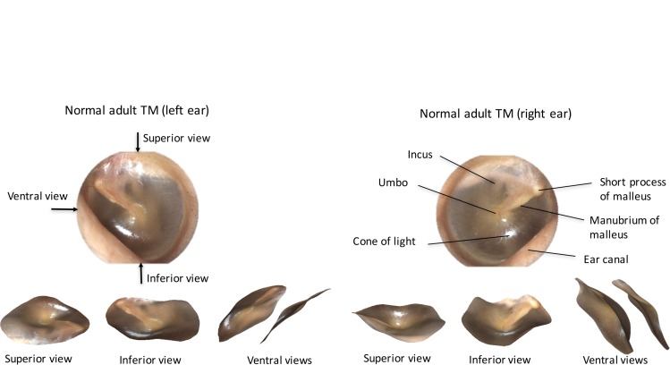 Fig. 10