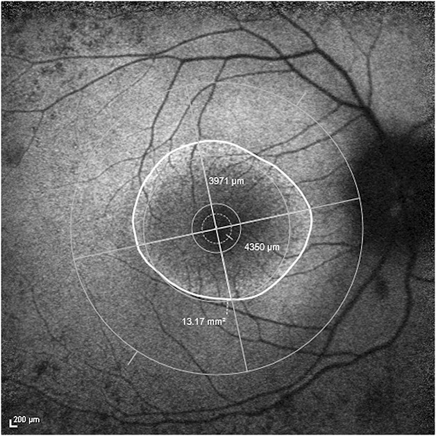 Fig. 2.