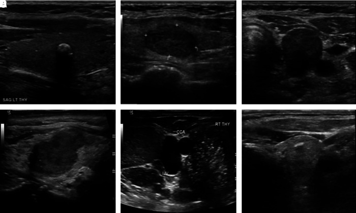 FIG. 2.